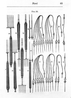 The uses of electrolysis in surgery / by W.E. Steavenson.