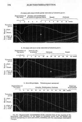 Von Ziemssen's handbook of general therapeutics.