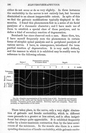 Von Ziemssen's handbook of general therapeutics.