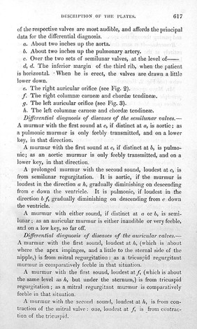 Description of contraction of the mitral valve.