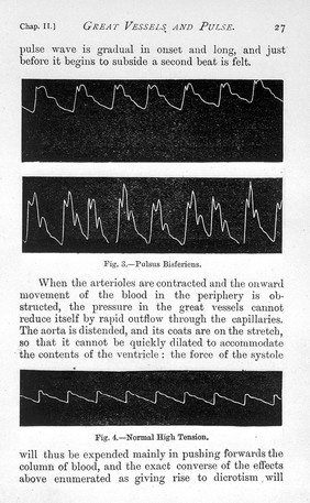 The pulse / by W.H. Broadbent.