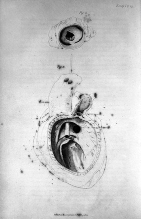 Pathological researches. Essay I: On malformations of the human heart ... preceded by some observations on the method of improving the diagnostic part of medicine / [J.R. Farre].