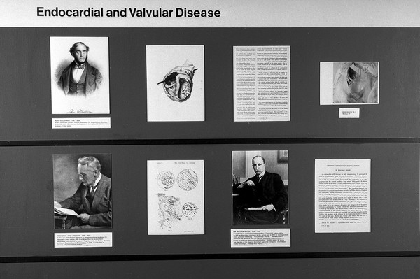 Panels of Heart Exhibition: Endocardial and Valvular Disease.
