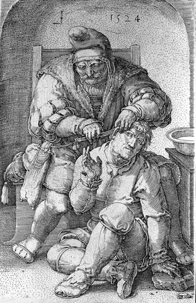 An itinerant surgeon extracting stones from a man's head; symbolising the expulsion of 'folly' (insanity) Line engraving by L. van Leyden, 1524.