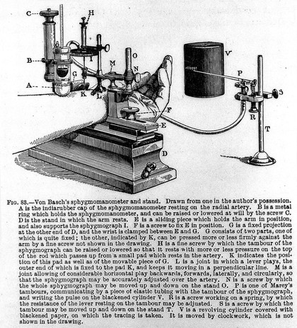 Engraving: sphygmomanometer devised by S.S. von Basch, circa 1881.