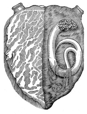 view A worm found in the left ventricle