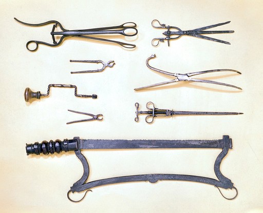 Surgical instruments of the 16th and 17th centuries.