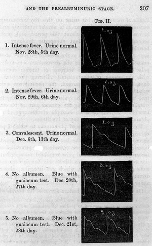 view Tracings of pulse in disease.