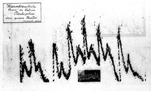 view Tracing of the pulse of a dog.