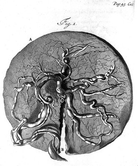 Frederici Ruyschii ... Observationum anatomico-chirurgicarum centuria : accedit Catalogus rariorum, quae in Museo Ruyschiano asservantur, adjectis ubique iconibus aeneis naturalem magnitudinem repraesentantibus / [Frederik Ruysch].