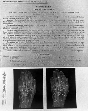 The Edinburgh stereoscopic atlas of anatomy / edited by David Waterston.