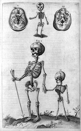 Skeletons of child and foetus, 16th Century