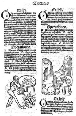 Ortus sanitatis.
