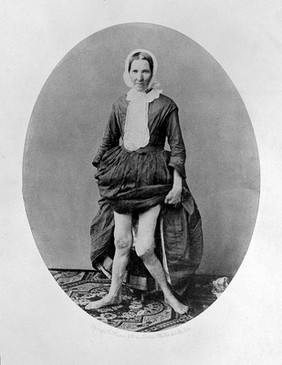 A woman standing: a full length view from the front, in which she reveals her legs by raising her dress. Photograph by L. Haase after H.W. Berend, 1859.