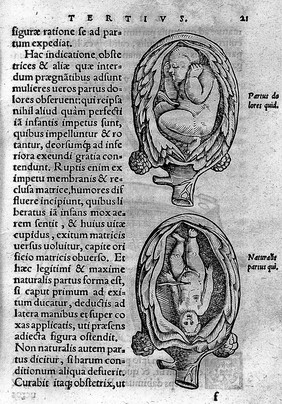 De conceptu et generatione hominis, et iis quae circa haec potissimum consyderantur libri sex ... Insertae quoque sunt picturae variae foetus, primum in utero siti, deinde in partu, mox etiam matricis et instrumentorum ad partum ... pertinentium ... postremo variorum monstrorum insuper / [Jakob Rueff].