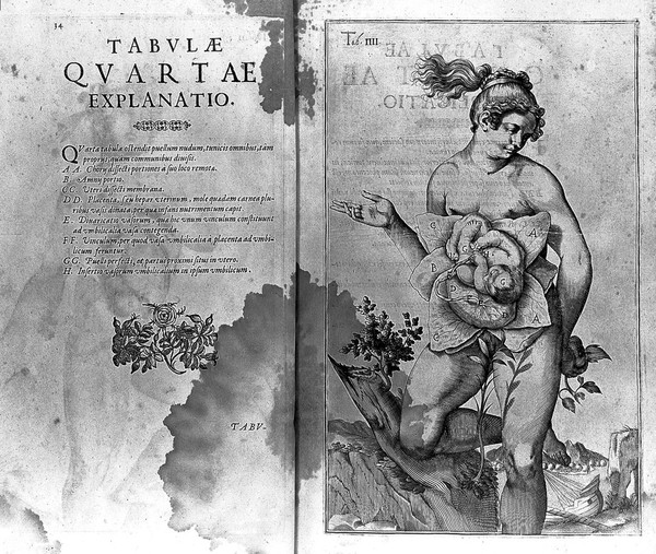 De formato foetu liber singularis aeneis figuris exornatus. Epistolae duae anatomicae. Tractatus de arthritide / Opera posthuma, studio Liberalis Cremae ... edita.