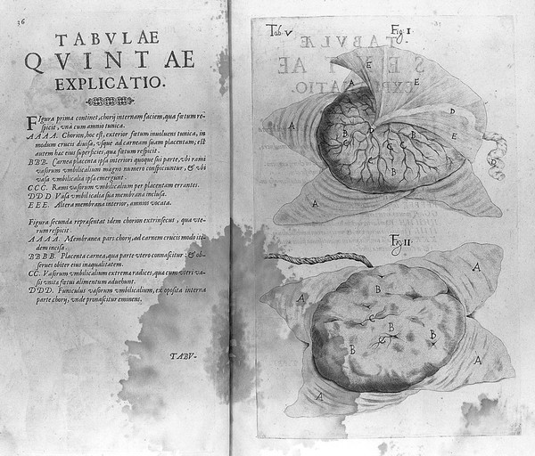De formato foetu liber singularis aeneis figuris exornatus. Epistolae duae anatomicae. Tractatus de arthritide / Opera posthuma, studio Liberalis Cremae ... edita.