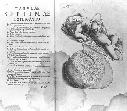 De formato foetu liber singularis aeneis figuris exornatus. Epistolae duae anatomicae. Tractatus de arthritide / Opera posthuma, studio Liberalis Cremae ... edita.