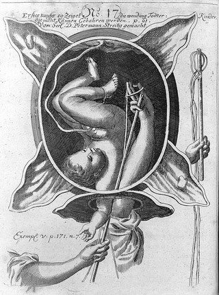 Die königl. preussische und chur-brandenb. Hof-Wehe-Mütter, das ist: ein höchst nöthiger Unterricht von schweren und unrecht-stehenden Gebuhrten, in einem Gespräch vorgestellet / Justinen Siegemunden.