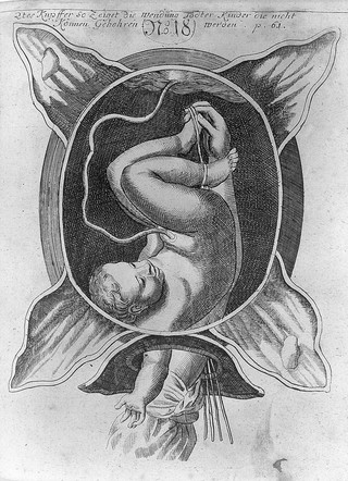 Die königl. preussische und chur-brandenb. Hof-Wehe-Mütter, das ist: ein höchst nöthiger Unterricht von schweren und unrecht-stehenden Gebuhrten, in einem Gespräch vorgestellet / Justinen Siegemunden.