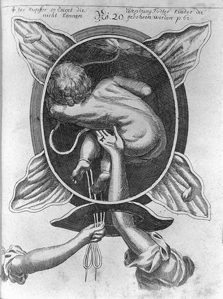 Die königl. preussische und chur-brandenb. Hof-Wehe-Mütter, das ist: ein höchst nöthiger Unterricht von schweren und unrecht-stehenden Gebuhrten, in einem Gespräch vorgestellet / Justinen Siegemunden.