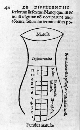 Woodcut of urine flask.