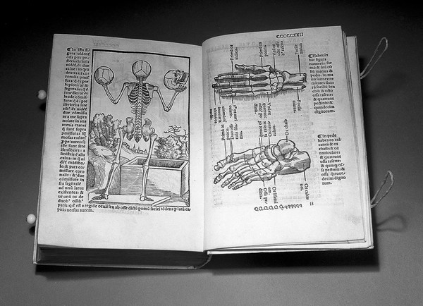 Carpi commentaria cũm amplissimis additionibus super Anatomia Mũndini vna cum textu eiusdẽm in pristinũm et verum nitorèm redacto / [Jacopo Berengario da Carpi].