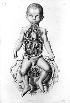 Traité complet de l'anatomie de l'homme comprenant la médecine opératoire ... : avec planches lithographiées ... / par N.H. Jacob.