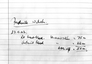 view J. MacMichael's Case book: cardiac catherization.