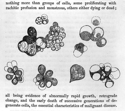 On ovarian and uterine tumours : their diagnosis and treatment / by T. Spencer Wells.