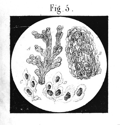 De l'urine et des sédiments urinaires : propriétés et caractères chimiques et microscopiques des élements normaux et anormaux de l'urine analyse qualitative et quantitative de cette sécrétion, description et valeur séméiologique de ses altérations pathologiques, etc / par G. [sic] Neubauer, J. Vogel.
