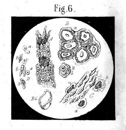 De l'urine et des sédiments urinaires : propriétés et caractères chimiques et microscopiques des élements normaux et anormaux de l'urine analyse qualitative et quantitative de cette sécrétion, description et valeur séméiologique de ses altérations pathologiques, etc / par G. [sic] Neubauer, J. Vogel.