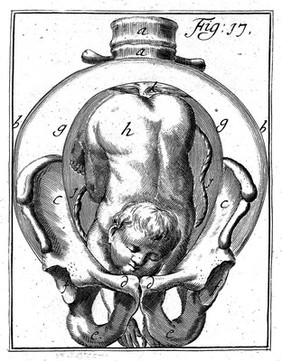 Operationes chirurgicae novum lumen exhibentes obstetricantibus, quo fideliter manifestatur ars obstetricandi. Et quidquid ad eam requiritur ... / [Hendrik van Deventer].