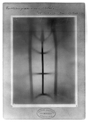 Unloading apparatus with leaden cage, viewed under x-ray. Photoprint from radiograph by W.K. Röntgen, 1895.