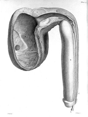 A treatise on the venereal disease / By John Hunter.