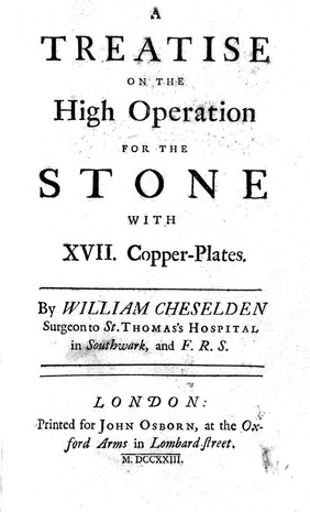 A treatise on the high operation for the stone ... / By William Cheselden.