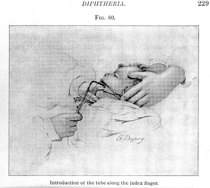 The diseases of infancy and childhood : designed for the use of students and practitioners of medicine / by Henry Koplik.