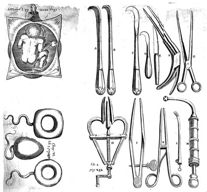 The diseases of women with child, and in child-bed: as also the best means of helping them in natural and unnatural labours. With fit remedies for the several indispositions of new-born babes. To which is prefix'd an Anatomical treatise ... Written in French / ... Translated by Hugh Chamberlen, M. D.