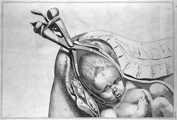 A sett of anatomical tables, with explanations, and an abridgment, of the practice of midwifery, with a view to illustrate a treatise on that subject, and collection of cases / By William Smellie, M.D.