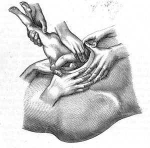 view F. W. Scanzoni von Lichtenfels, Lehrbuch der Geburtshilfe