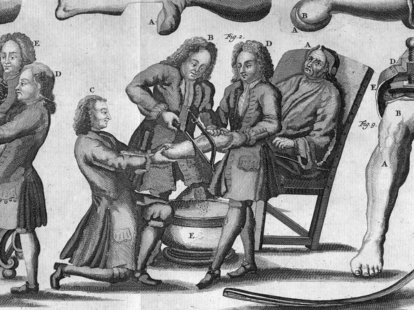 D. Lavrentii Heisteri sereniss. Brunsiucens. ... Institvtiones chirvrgicae in qvibvs qvicqvid ad rem chirvrgicam pertinet, optima et novissima ratione pertractatvr atque in tabulis multis aeneis praestantissima ac maxime necessaria instrumenta itemque artificia, sive encheirises praecipuae et vincturae chirurgicae repraesentantur. Opvs triginta annorvm, nunc demum, post aliquot editiones Germanica lingua evulgatas, in exterorum gratium Latine publicatum / [Lorenz Heister].