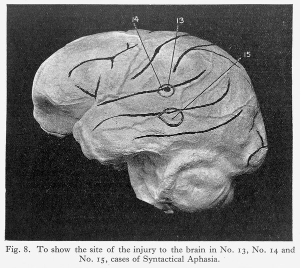 Aphasia / [S.A. Kinnier Wilson].