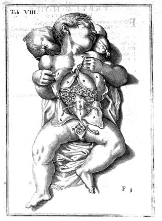 Adriani Spigelii Brvxellensis Eqvitis D. Marci ... De formato foetv liber singularis aeneis figvris exornatvs. Epistolæ dvæ anatomicæ. Tractatvs de arthritide. Opera posthvma, studio Liberalis Cremae tarvisini philosoph. & medicinæ doctoris edita / [Adriaan van de Spiegel].