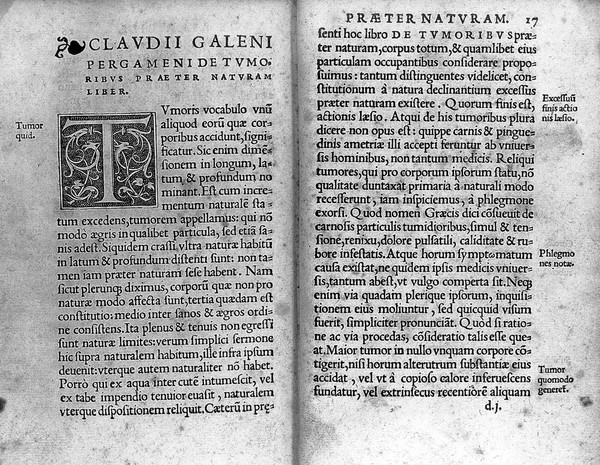 De atra bile, liber. De tumoribus praeter naturam, liber / Guinterio Joanne Andernaco interprete.