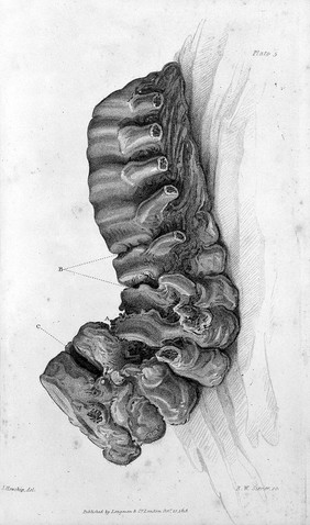 Pathological and surgical observations on diseases of the joints / [Sir Benjamin C. Brodie].