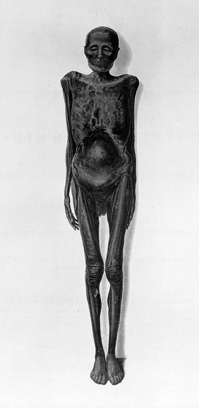 A history of Egyptian mummies, and an account of the worship and embalming of the sacred animals by the Egyptians; with remarks on the funeral ceremonies of different nations, and observations on the mummies of the Canary Islands, of the ancient Peruvians, Burman priests, etc / By Thomas Joseph Pettigrew.