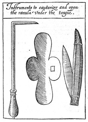 A discourse of the whole art of chyrurgerie. Wherein is exactly set downe the definition, causes, accidents, prognostications, and cures of all sorts of diseases ... Wherunto is added the rule of making remedies which chirurgions doe commonly use: with the Presages of divine Hyppocrates / [Peter Lowe].