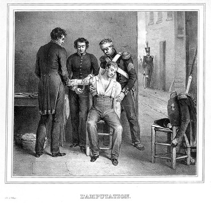 A soldier having an arm amputated. Lithograph by Villain.