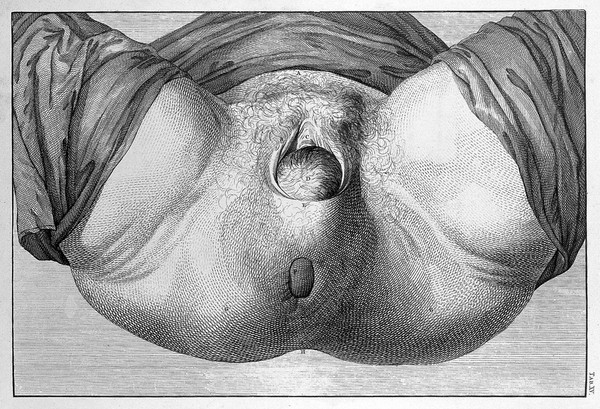 A sett of anatomical tables, with explanations, and an abridgment, of the practice of midwifery, with a view to illustrate a treatise on that subject, and collection of cases / By William Smellie, M.D.