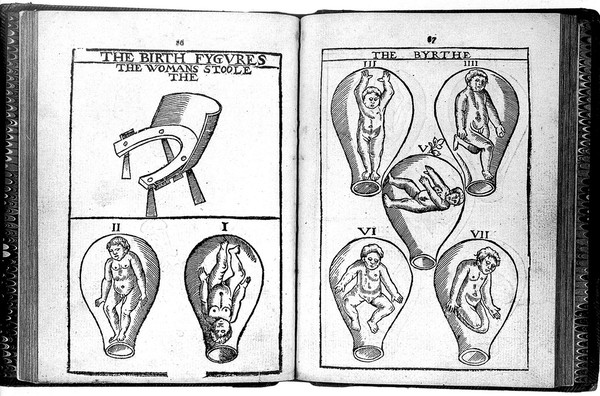 The birth of mankinde, otherwyse named The vvomans booke. : Set foorth in English by Thomas Raynalde phisition, and by him corrected, and augmented. Whose contents yee may reade in the table folowyng: but most playnely in the prologue.